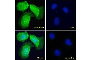 ABIN185357 Immunofluorescence analysis of paraformaldehyde fixed U2OS cells, permeabilized with 0. (Acetylcholinesterase antibody  (C-Term))
