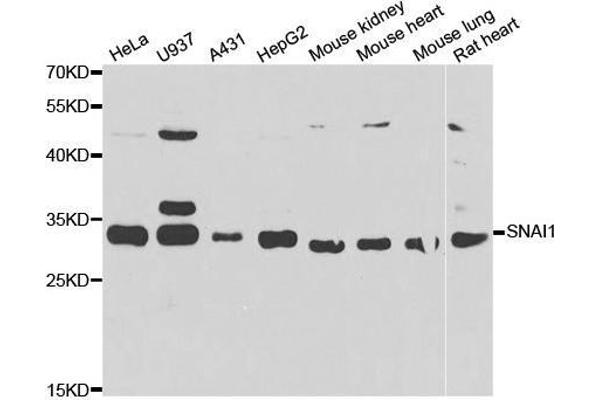 SNAIL antibody  (AA 1-100)