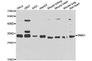 SNAIL antibody  (AA 1-100)
