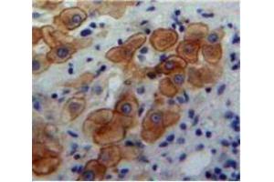 IHC-P analysis of Liver tissue, with DAB staining. (BMP5 antibody  (AA 317-454))