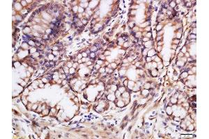 Formalin-fixed and paraffin embedded mouse colon labeled with Rabbit Anti-Glutamine synthetase Polyclonal Antibody, Unconjugated (ABIN754468) at 1:200 followed by conjugation to the secondary antibody and DAB staining (GLN1 antibody  (AA 285-373))