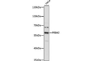 Western blot analysis of extracts of HeLa cells, using PRIM2 antibody (ABIN6130292, ABIN6146165, ABIN6146167 and ABIN6215363) at 1:3000 dilution.