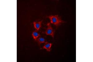 Immunofluorescent analysis of Collagen 4 alpha 5 staining in HeLa cells. (COL4a5 antibody  (N-Term))