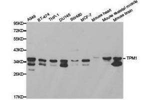 Western Blotting (WB) image for anti-Tropomyosin 1 (Alpha) (TPM1) antibody (ABIN1875180) (Tropomyosin antibody)
