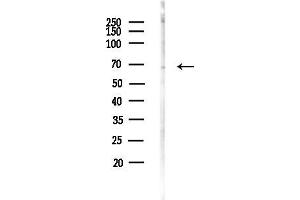 Western blot analysis of lysates from COLO205 cells, using SLC6 Antibody at 1/1000 dilution.