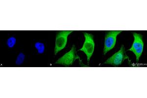 Immunocytochemistry/Immunofluorescence analysis using Mouse Anti-Ubiquitin Monoclonal Antibody, Clone 5B9-B3 . (Ubiquitin antibody  (FITC))