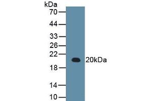 Detection of Recombinant RARS, Human using Monoclonal Antibody to Arginyl tRNA Synthetase (RARS) (RARS antibody  (AA 1-146))