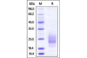Mouse TIGIT, His Tag on SDS-PAGE under reducing (R) condition. (TIGIT Protein (AA 26-143) (His tag))