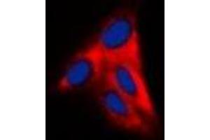 Immunofluorescent analysis of Alpha-tubulin staining in Hela cells. (alpha Tubulin antibody  (C-Term))