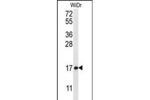 TBCA Antibody (N-term) (ABIN656928 and ABIN2846121) western blot analysis in WiDr cell line lysates (35 μg/lane).