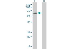 Western Blot analysis of PCK1 expression in transfected 293T cell line by PCK1 monoclonal antibody (M01), clone 3E4. (PCK1 antibody  (AA 1-622))