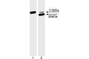 Western Blotting (WB) image for anti-Poly (ADP-Ribose) Polymerase 1 (PARP1) (full length) antibody (ABIN967515) (PARP1 antibody  (full length))