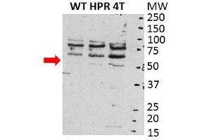 SRC antibody - N-terminal region  validated by WB using total cell lysate from human ovarian carcinoma cells at 1:1000. (Src antibody  (N-Term))