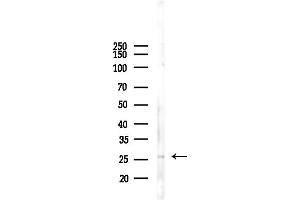 anti-Breast Cancer Metastasis Suppressor 1 (BRMS1) (N-Term) antibody
