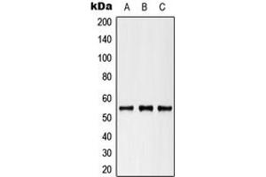 Western blot analysis of Cytokeratin 8 (pS73) expression in HeLa (A), NIH3T3 (B), H9C2 (C) whole cell lysates. (KRT8 antibody  (pSer73))