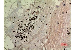 Immunohistochemistry (IHC) analysis of paraffin-embedded Human Breast, antibody was diluted at 1:100. (p53 antibody  (acLys370))