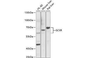 Western blot analysis of extracts of various cell lines, using GCKR Antibody (ABIN6131695, ABIN6141014, ABIN6141015 and ABIN6221331) at 1:1000 dilution.