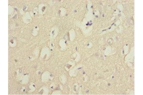 FOXN2 antibody  (AA 172-431)