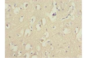Immunohistochemistry of paraffin-embedded human brain tissue using ABIN7153074 at dilution of 1:100