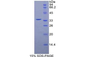 SDS-PAGE analysis of Mouse MYLK4 Protein. (MYLK4 Protein)
