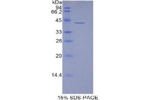 HIST1H2AJ Protein