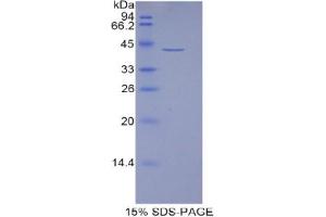 SDS-PAGE analysis of Human HIST1H2AJ Protein. (HIST1H2AJ Protein)