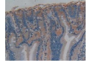 Immunohistochemistry (IHC) image for anti-Microtubule-Associated Protein tau (MAPT) (AA 34-368) antibody (ABIN7434482)