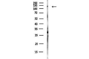 Western blot analysis of lysates from HUVEC cells(UV,30 min treatment), using DHX37 Antibody at 1/1000 dilution.