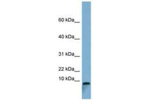 Image no. 1 for anti-T-Cell Leukemia Translocation Altered (TCTA) (C-Term) antibody (ABIN6741765) (TCTA antibody  (C-Term))