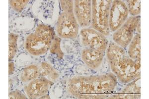 Immunoperoxidase of monoclonal antibody to OCRL on formalin-fixed paraffin-embedded human kidney. (OCRL antibody  (AA 146-239))