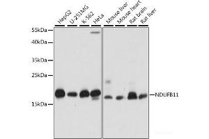 Western blot analysis of extracts of various cell lines using NDUFB11 Polyclonal Antibody at dilution of 1:1000. (NDUFB11 antibody)