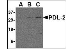 Western blot analysis of PDL-2 in Raji cell lysate with this product at (A) 0. (PDCD1LG2 antibody  (Center))