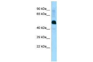 Host:  Rabbit  Target Name:  Lrrfip1  Sample Type:  Mouse Muscle lysates  Antibody Dilution:  1. (LRRFIP1 antibody  (Middle Region))