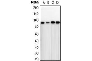 Western blot analysis of TLK1 expression in HeLa (A), A431 (B), NIH3T3 (C), rat thymus (D) whole cell lysates. (TLK1 antibody  (Center))