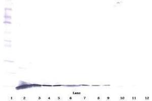 Image no. 2 for anti-Nerve Growth Factor (NGF) antibody (ABIN465645) (Nerve Growth Factor antibody)