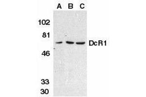 Western blot analysis of DcR1 in HeLa cell (A), mouse (B) and rat (C) liver tissue lysates with DcR1 antibody at 1μg/ml. (DcR1 antibody)