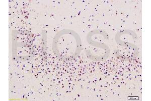 Formalin-fixed and paraffin embedded rat brain labeled with Rabbit Anti Cyclooxygenase 2/COX2 Polyclonal Antibody, Unconjugated (ABIN672471) at 1:200 followed by conjugation to the secondary antibody and DAB staining (PTGS2 antibody  (AA 501-604))