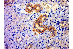 Paraformaldehyde-fixed, paraffin embedded rat thyroid, Antigen retrieval by boiling in sodium citrate buffer (pH6. (TXNDC11 antibody  (AA 601-700))