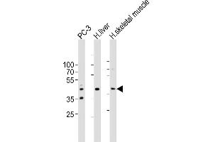 Western blot analysis of lysates from PC-3 cell line, human liver, human skeletal muscle tissue lysate(from left to right), using POC1A Antibody (C-term) ABIN6577916. (POC1A antibody  (C-Term))