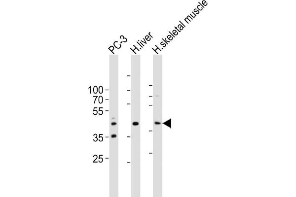 POC1A anticorps  (C-Term)