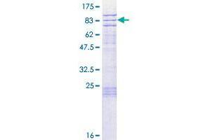 Image no. 1 for Chromosome 1 Open Reading Frame 124 (C1orf124) (AA 1-489) protein (GST tag) (ABIN1347305) (Spartan Protein (AA 1-489) (GST tag))