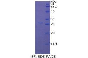 SDS-PAGE (SDS) image for Lysyl Oxidase-Like 1 (LOXL1) (AA 393-603) protein (His tag) (ABIN2125755)