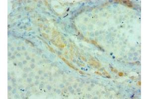 Immunohistochemistry of paraffin-embedded human testis tissue using ABIN7145198 at dilution of 1:100 (BIRC2 antibody  (AA 1-300))