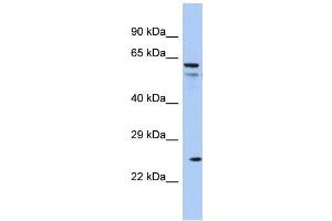 Host: Rabbit Target Name: AQP5 Sample Type: COLO205 Whole cell lysates Antibody Dilution: 1. (Aquaporin 5 antibody  (C-Term))