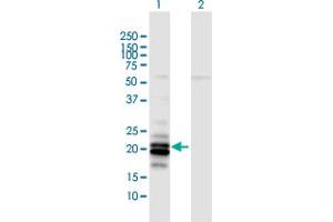Western Blot analysis of LCN2 expression in transfected 293T cell line by LCN2 MaxPab polyclonal antibody. (Lipocalin 2 antibody  (AA 1-198))