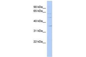 Image no. 1 for anti-Solute Carrier Family 22 (Organic Cation Transporter), Member 17 (SLC22A17) (AA 323-372) antibody (ABIN6743221) (SLC22A17 antibody  (AA 323-372))