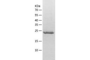 IGFBPI Protein (AA 26-259) (His tag)