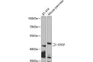 Western blot analysis of extracts of various cell lines, using SPOP antibody (ABIN6130703, ABIN6148374, ABIN6148376 and ABIN6223537) at 1:1000 dilution. (SPOP-B antibody  (AA 1-270))