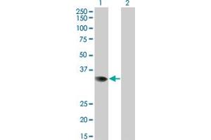 Western Blot analysis of PRPS2 expression in transfected 293T cell line by PRPS2 monoclonal antibody (M02), clone 4C1.