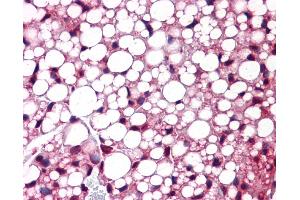 Immunohistochemistry (IHC) image for anti-Activating Transcription Factor 6 (ATF6) (C-Term) antibody (ABIN2779547) (ATF6 antibody  (C-Term))